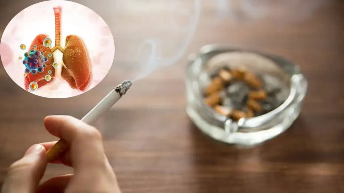 Why Not All Smokers Get Lung Cancer: New Insights from Research