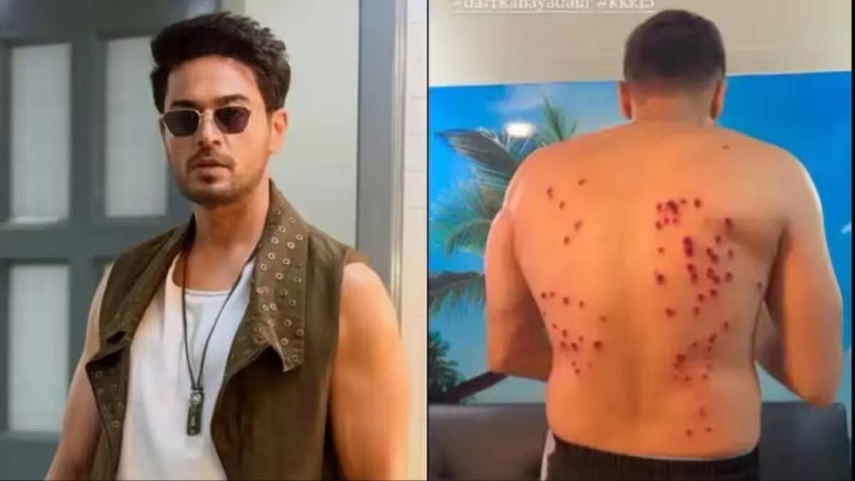 gaurav khanna faces injury on